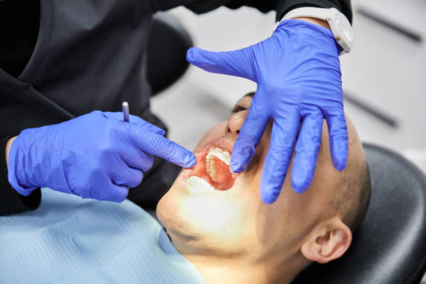 Best Knocked-Out Tooth (Avulsed Tooth) Treatment in Macopin, NJ